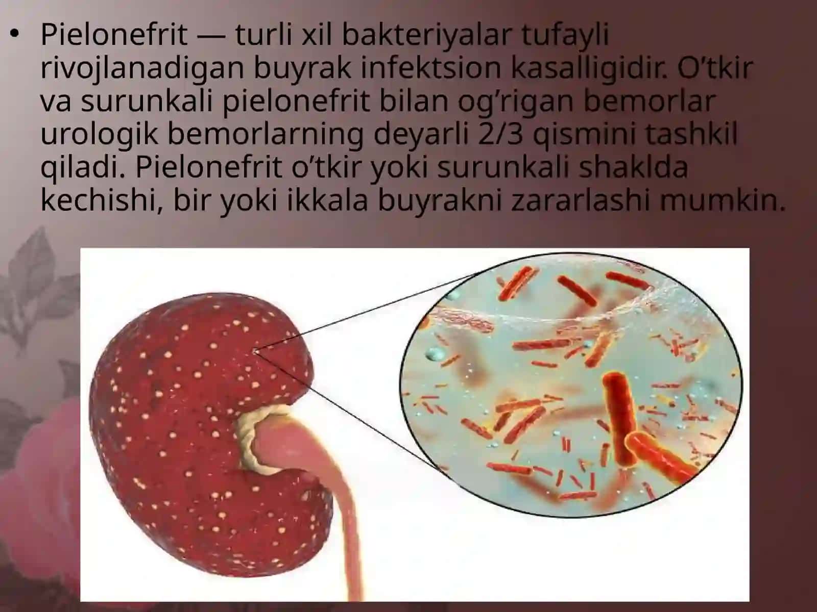 O`tkir va surunkali pielonefrit 2