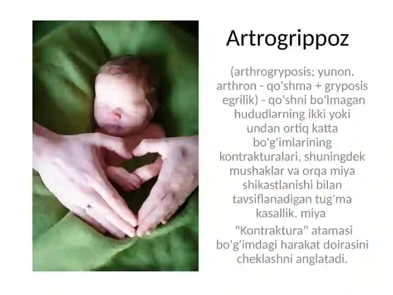 Artrogrippoz 2