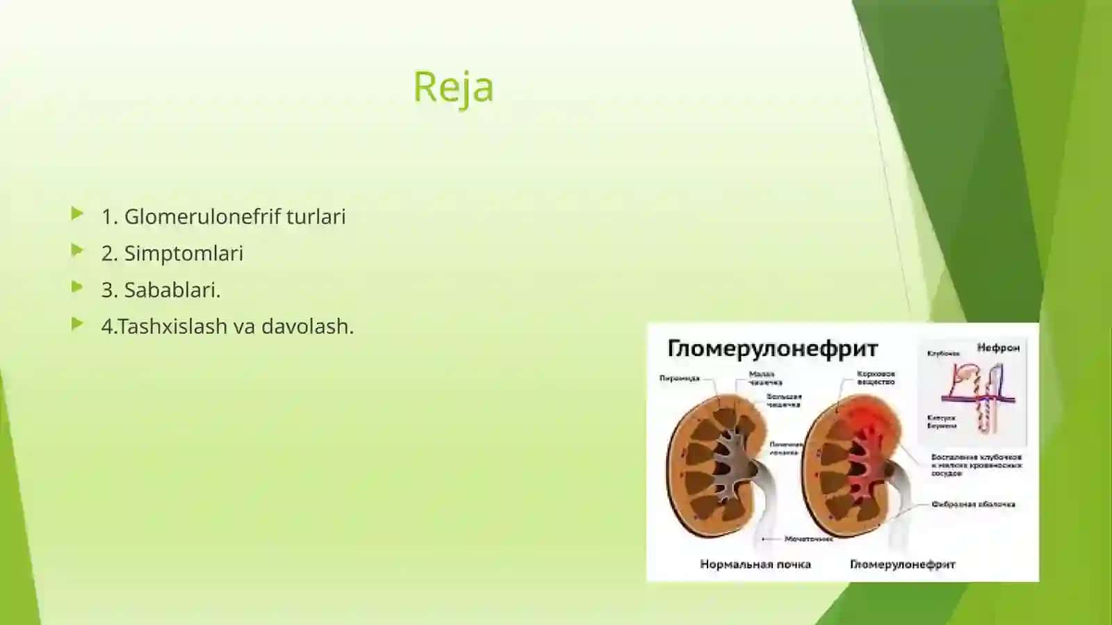 Glomerulonefrif klinikasi 2