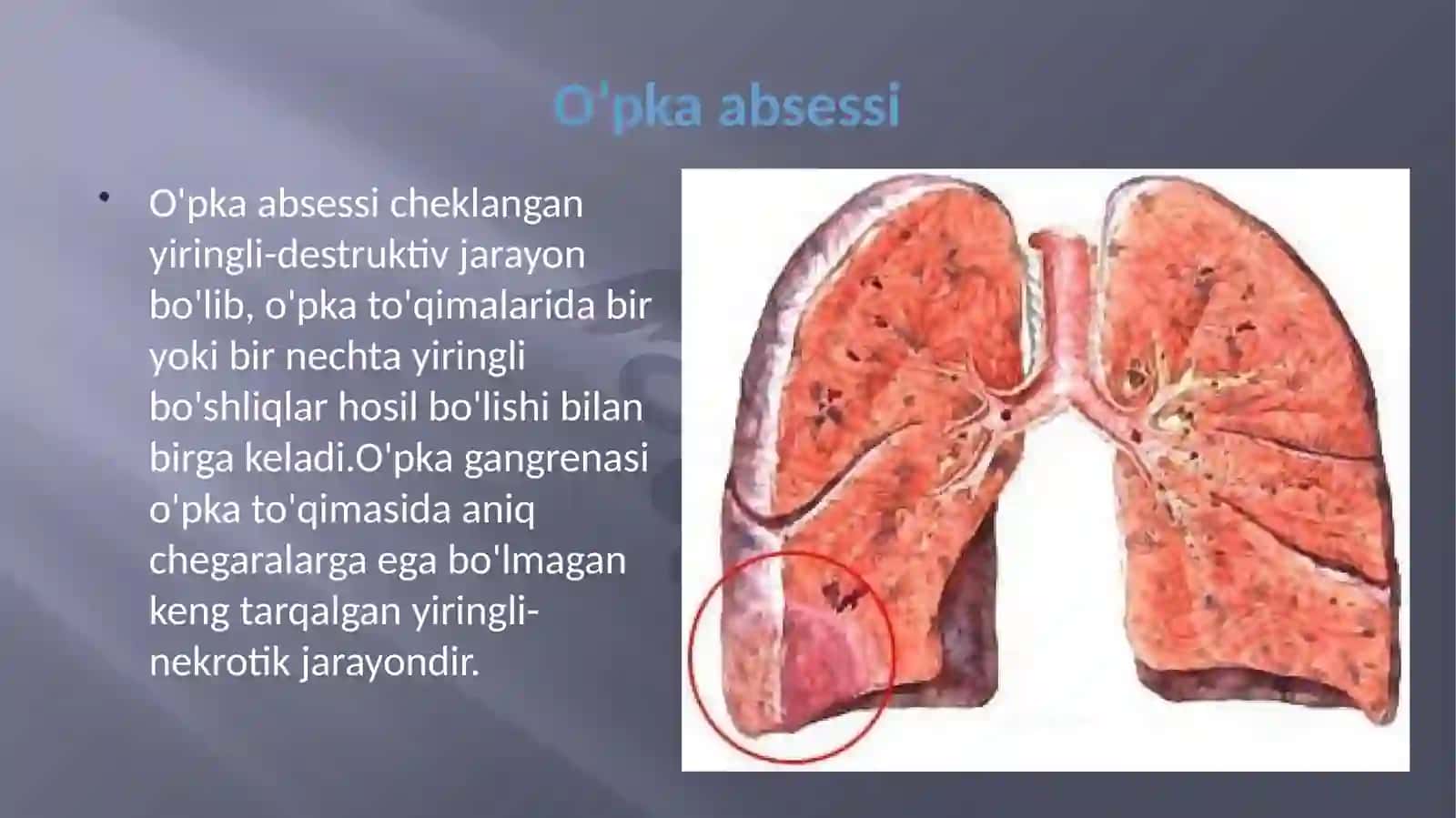 O’PKA ABSESSI VA GANGRENASI ETIOLOGIYASI, PATOGENEZI, KLINIKASI, LABORATORIYA TEKSHIRISH USULLARI, DAVOLASHCHORALARI 2
