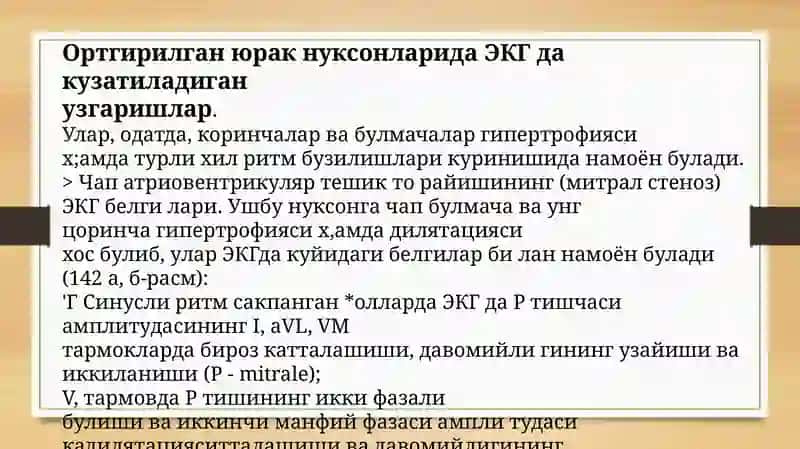 YURAK NUQSONLARIDA XAQIDA TUSHUNCHA  EKG OʻZGARISHLARNI ANIQLASH 2