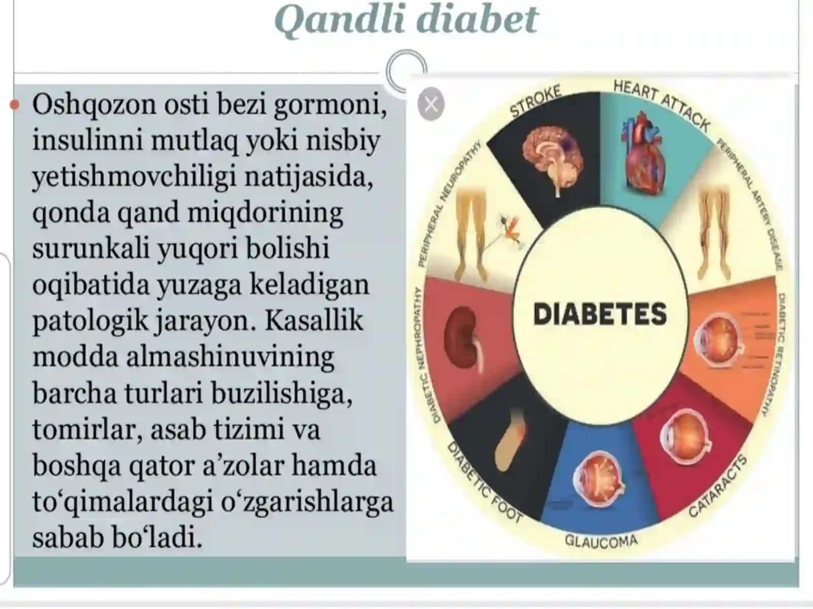 Qandli diabet. 1 va 2 tipdagi qandli diabetning epidemiologiyasi, tasnifi, klinik ko'rinishi, tashxislash 2