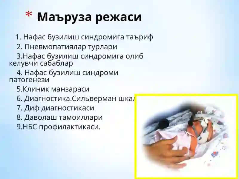 Нафас бузилиши синдроми 2