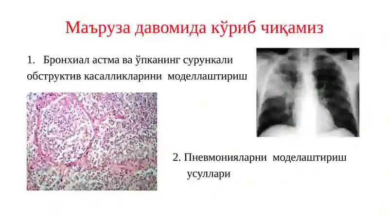 Бронхиал астма ва ўпканинг сурункали обструктив касалликларини моделлаштириш 2