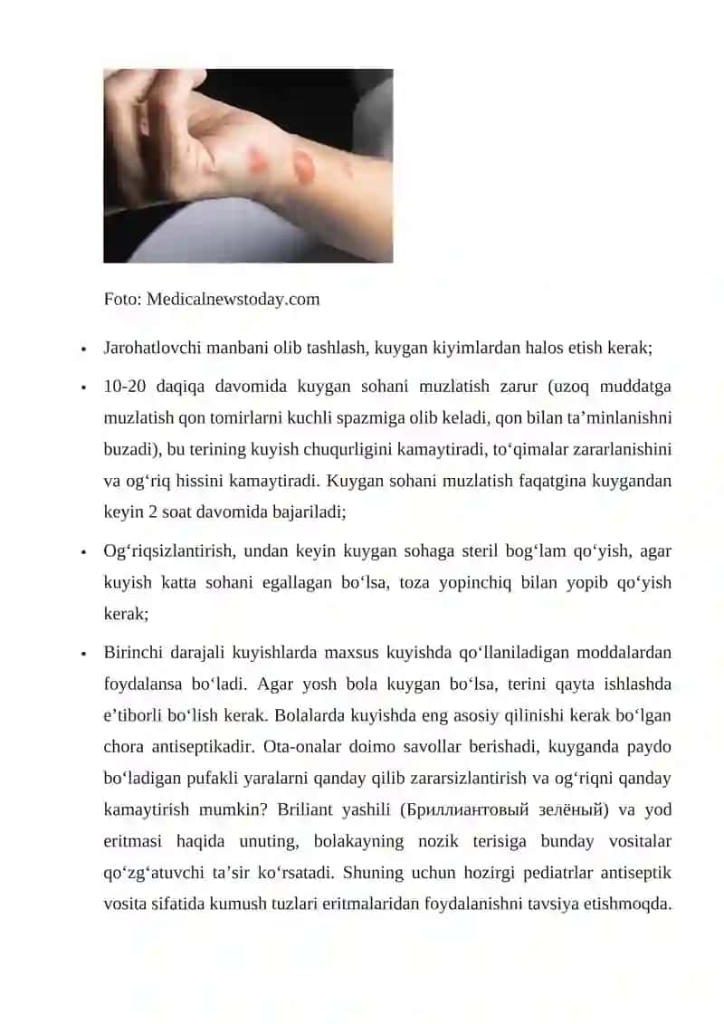 Kuyish - turlari, darajalari va birinchi yordam ko‘rsatish usullari 2