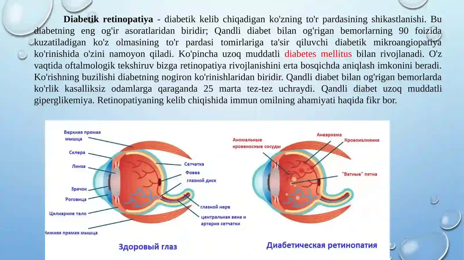Diabetik retinopatiya 2