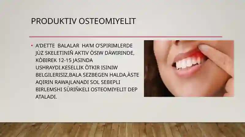 Produktiv osteomiyelit 2