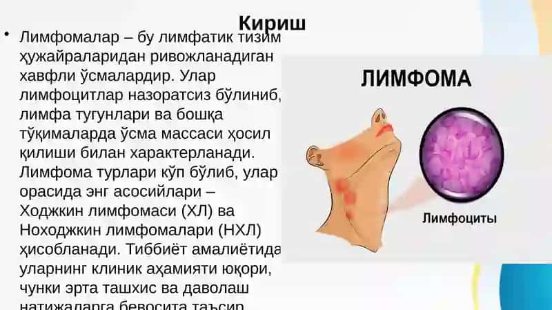 Ходжкин ва Ноходжкин лимфомалари . Xodjkin va Noxodjkin limfomalari 2