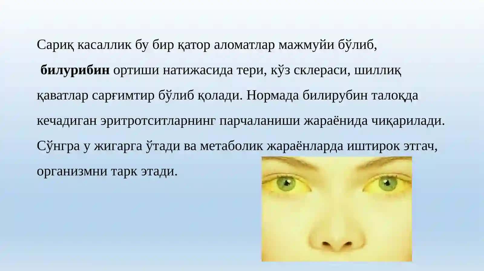 Билирубин алмашинув схемаси 2