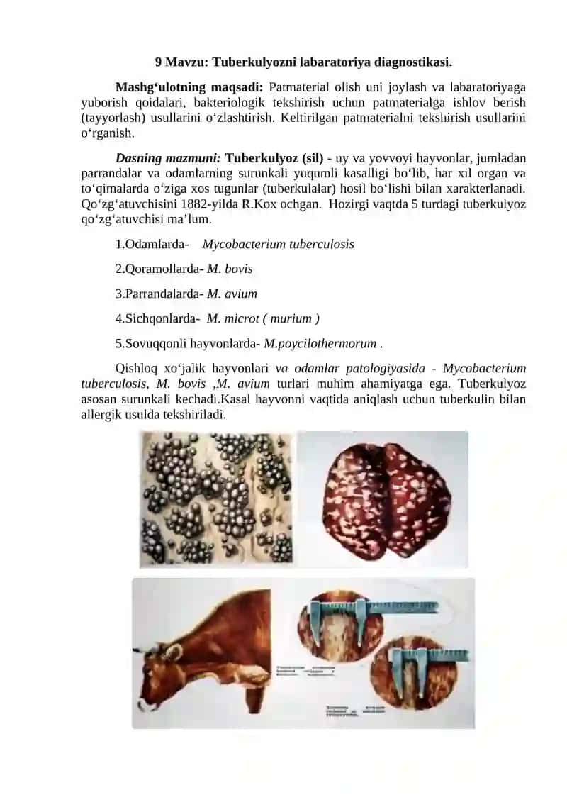 Tuberkullyozni laboratoriya diagnostikasi 2