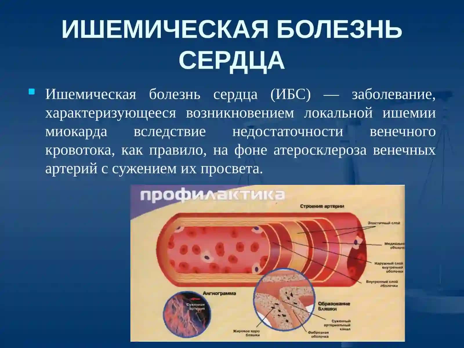ИШЕМИЧЕСКАЯ БОЛЕЗНЬ СЕРДЦА 2