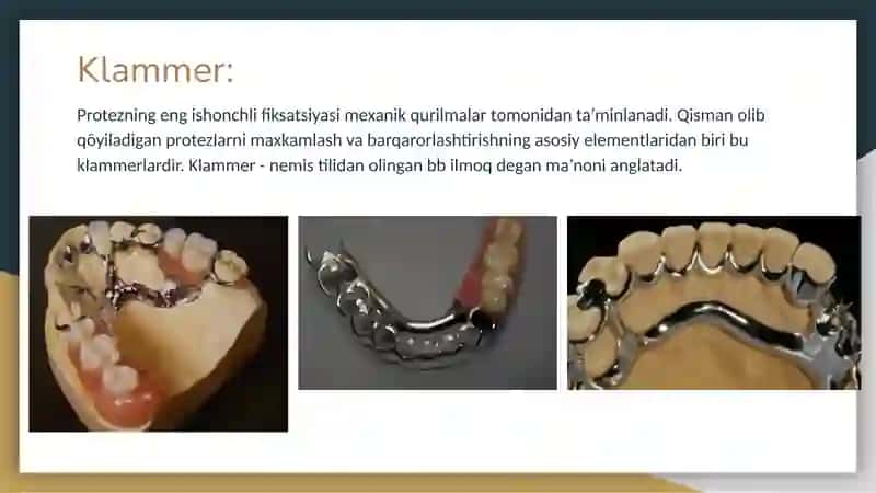 Klammerlar (tuğri reteynerlar), ularning turlari, vazifalari 2