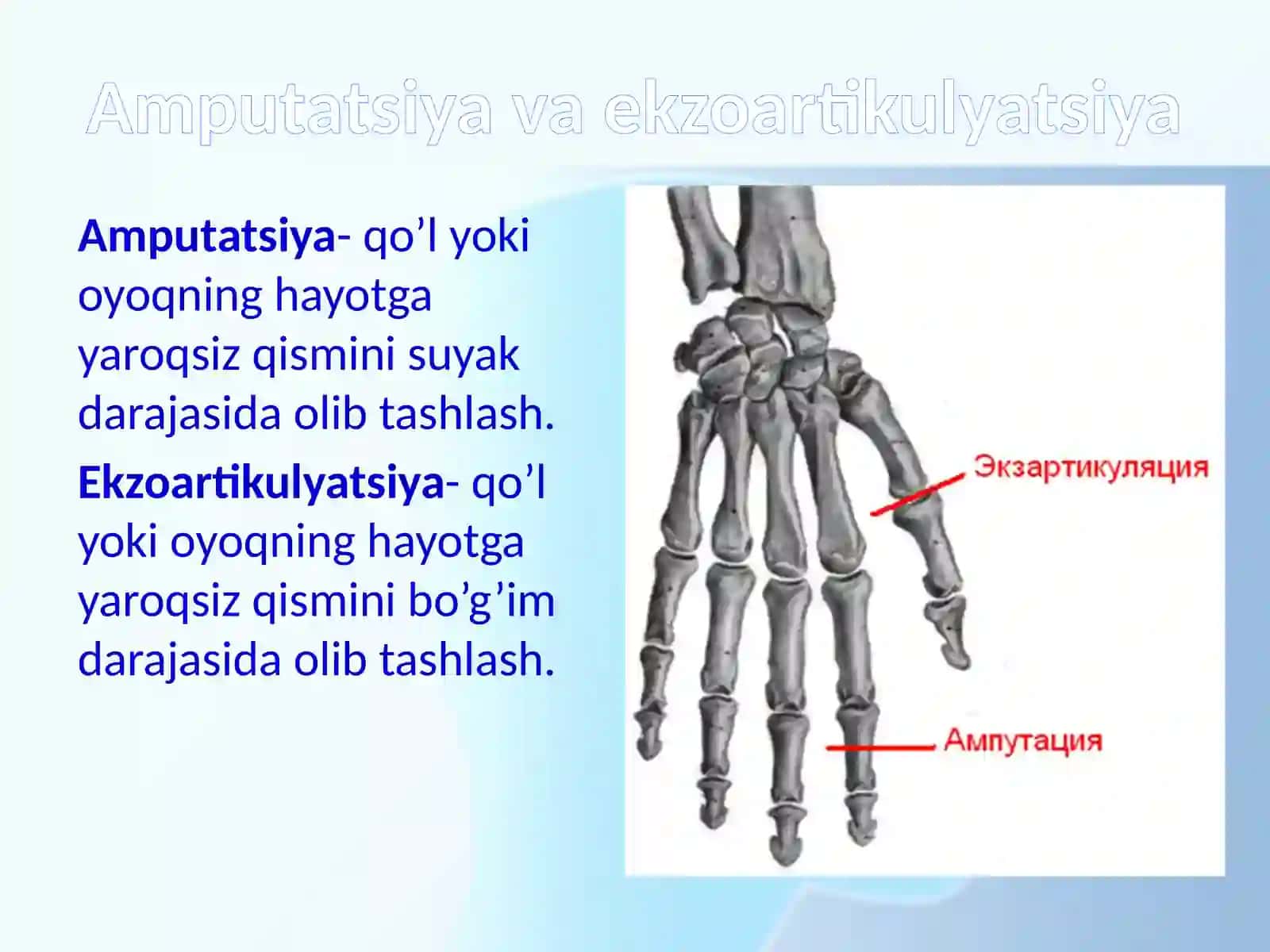 Amputastiya, protezlash ishlari va nogironlar reabilitastiyasi 2