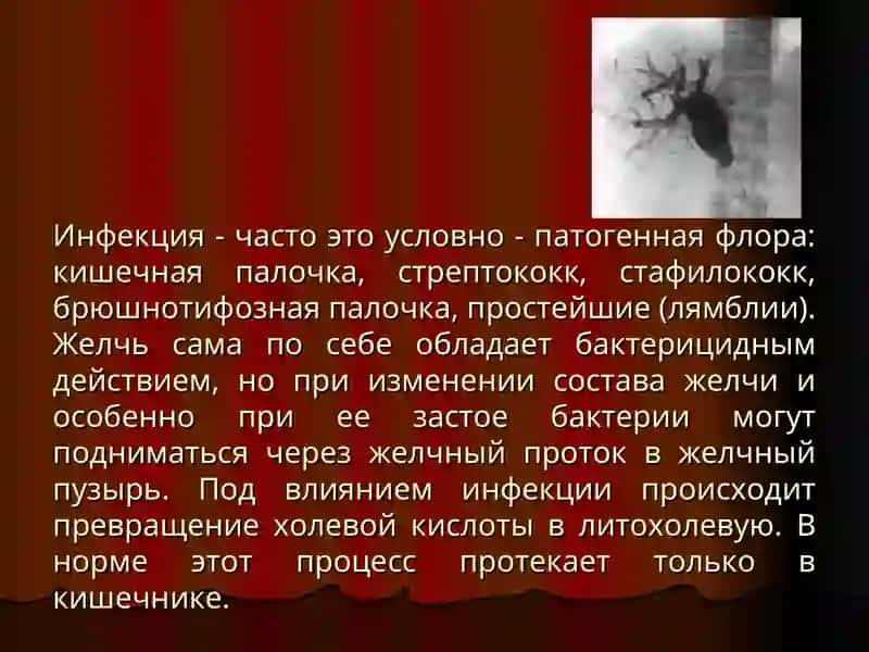 Механическая желтуха 2