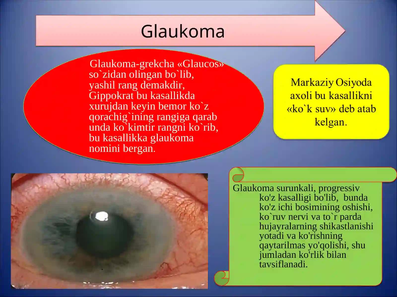 GLAUKOMA 2