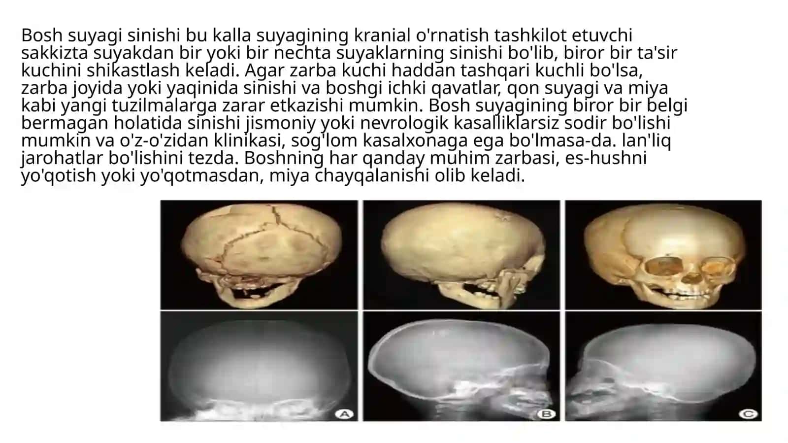 Kalla suyaklarining rentgenanatomiyasi 2
