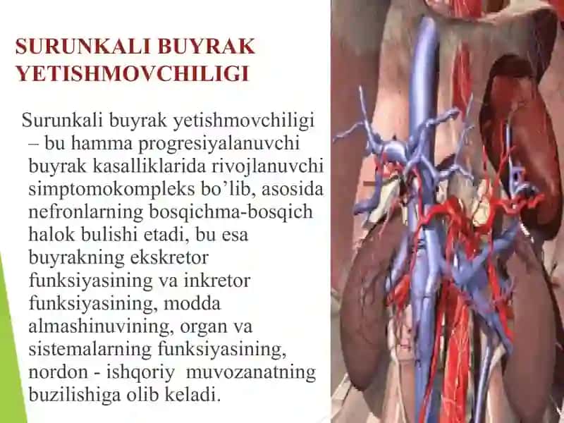 SURUNKALI BUYRAK YETISHMOVCHILIGI 2