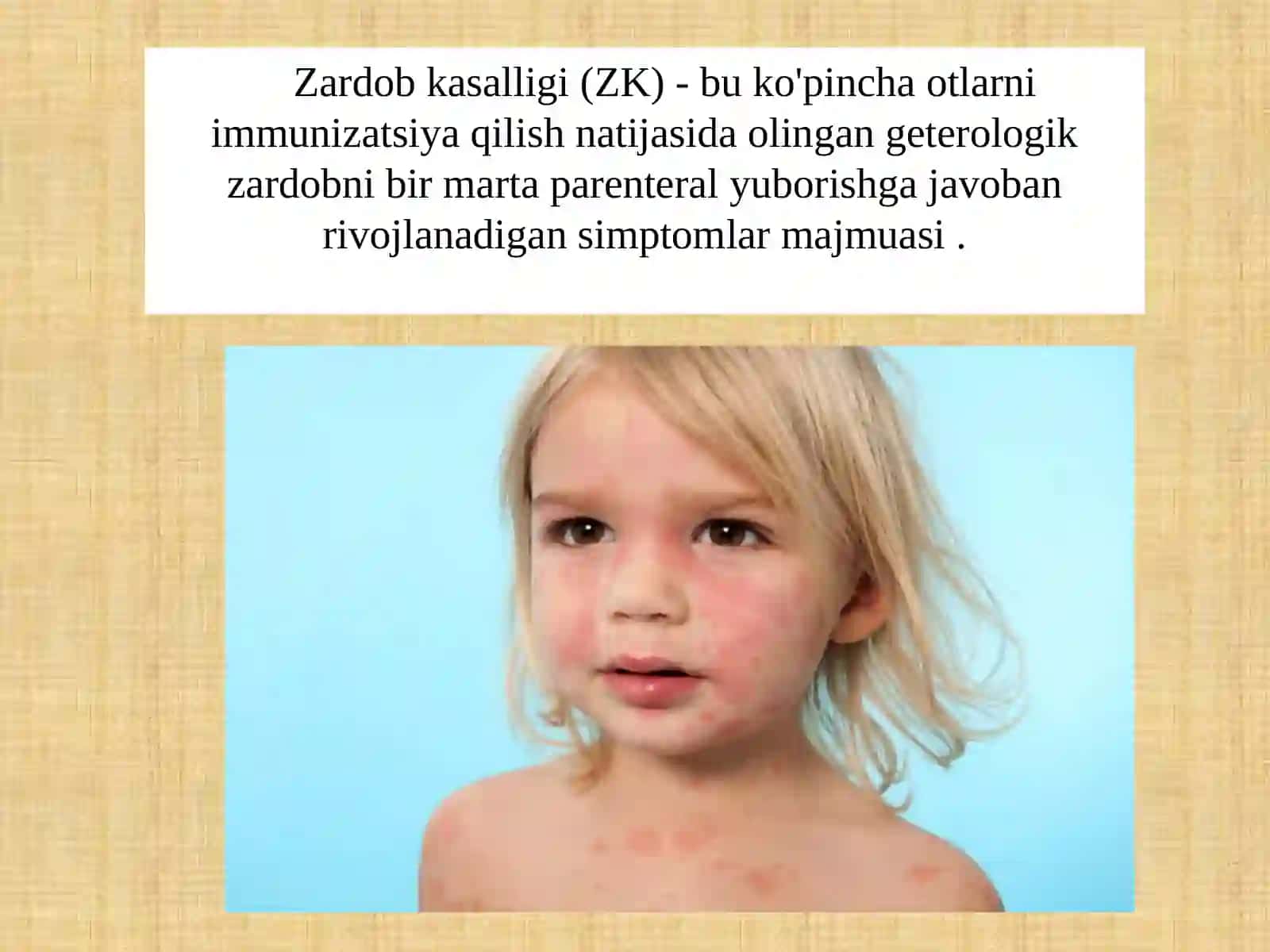 Zardobkasalligi 2