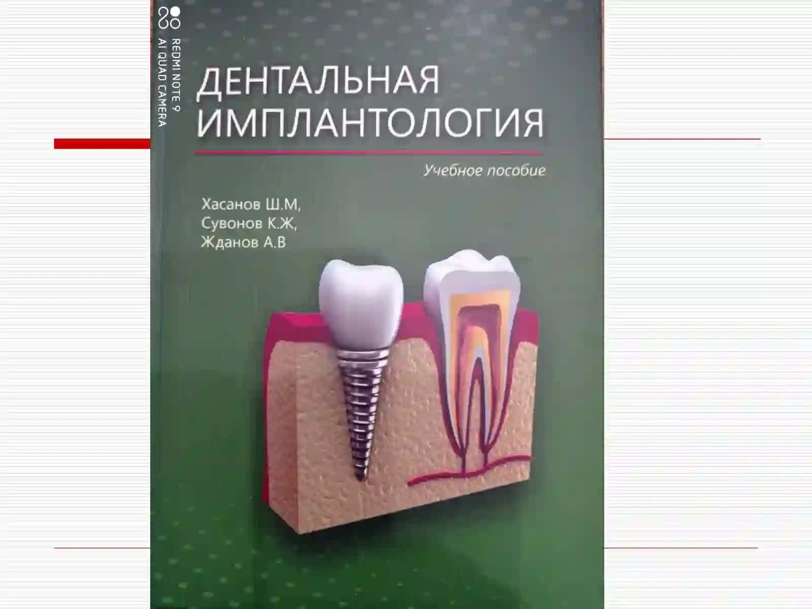 Дентал имплантация тарихи 2