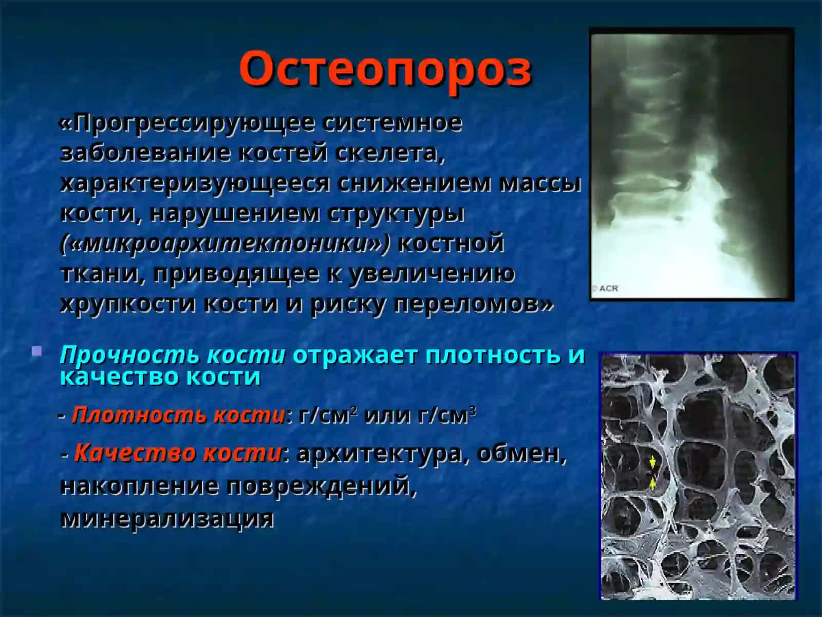 Современные принципы этиопатогенеза, диагностики и лечения остеопороза 2