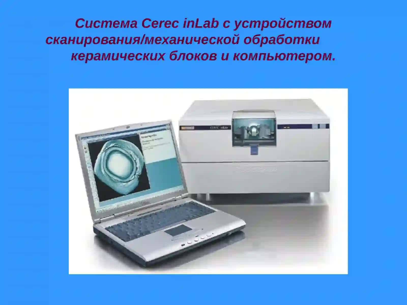CAD/CAM технологии Cerec in Lab 2
