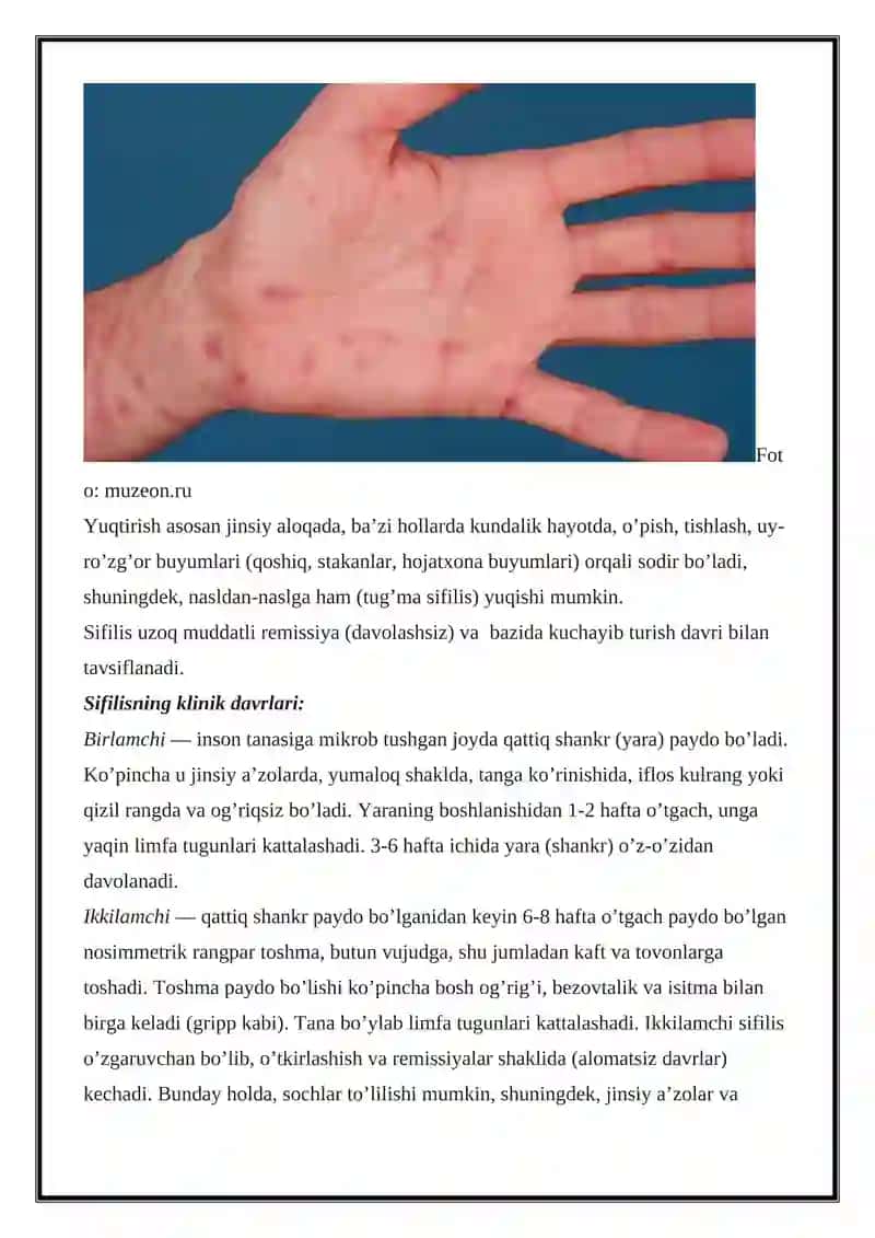Jinsiy yo'l bilan yuqadigan kasalliklar 2