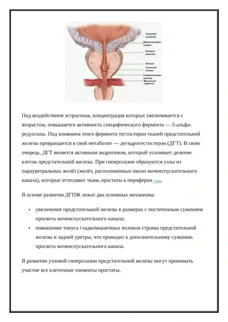 Аденома предстательной железы 2