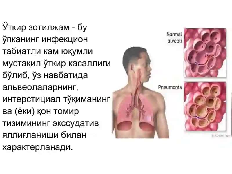 Ўткирзотилжамлар 2