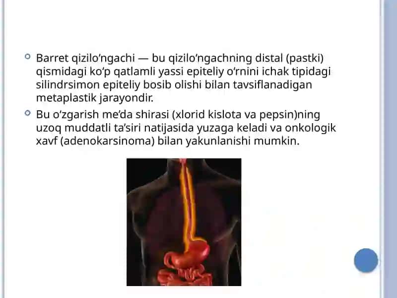 Barret qizilo‘ngachi 2