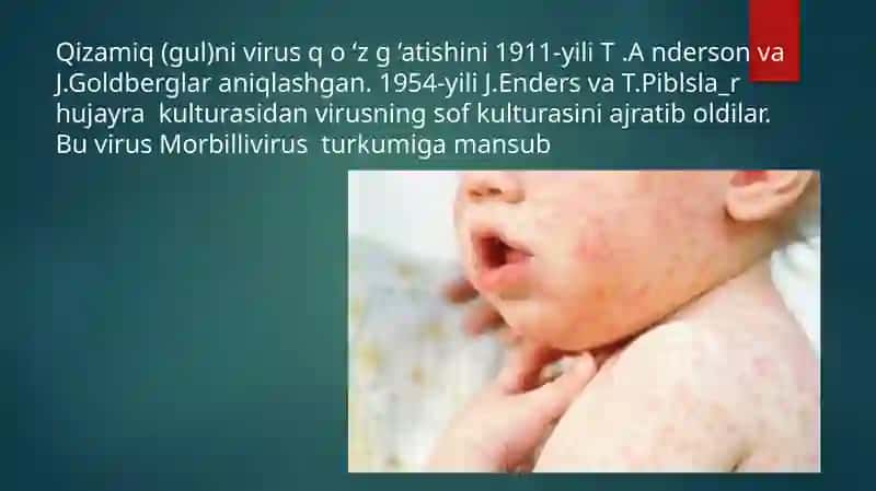 Morbillo viruslar klassifikatsiyasi patagenezi laboratoriya tashxisi 2
