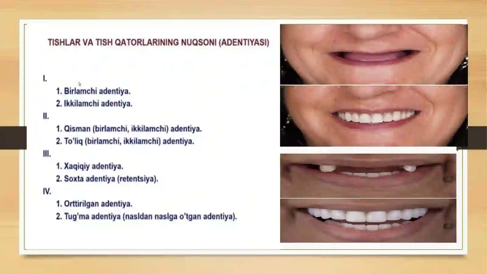 Tish qatorlari qisman nuqsonlari 2