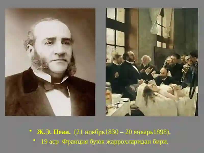 Меъда ва 12 бармокли ичак жаррохлигининг тарихий асослари 2