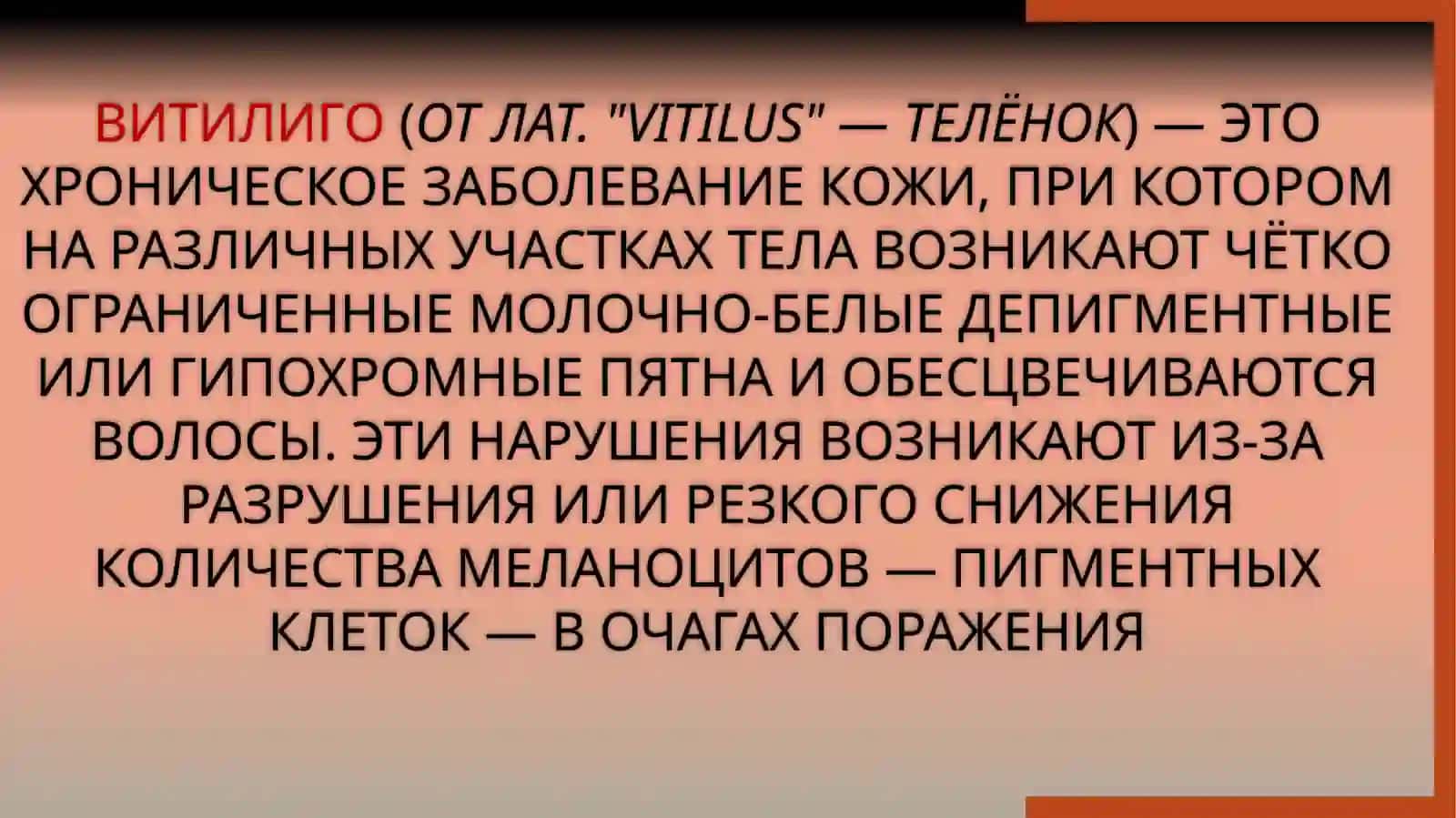 Витилиго 2