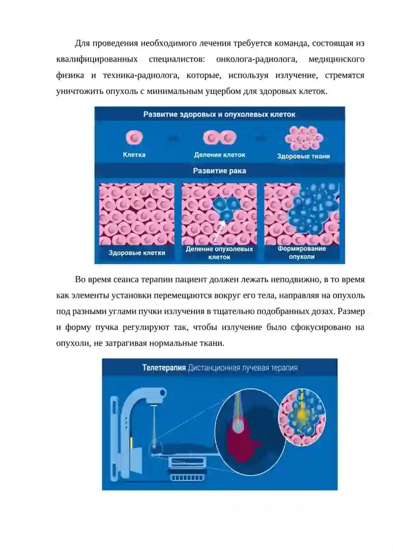 Лучевая терапия 2