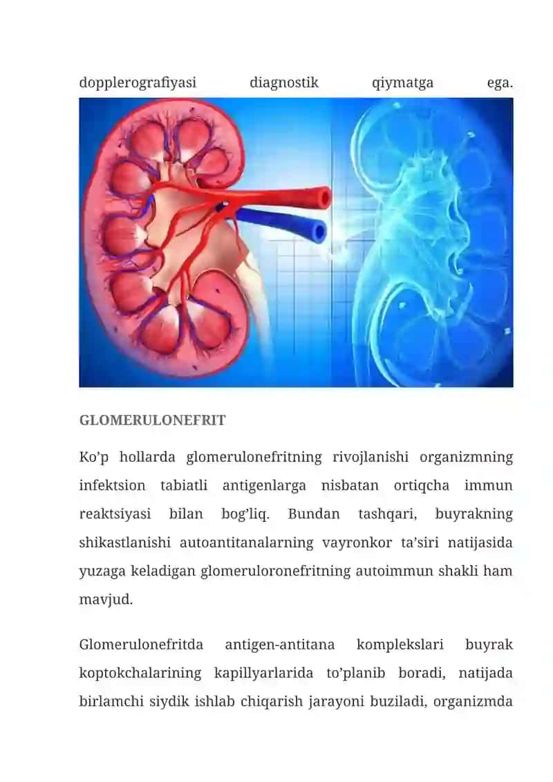 GLOMERULONEFRIT — SABABLARI, ALOMATLARI, TASHXISLASH, DAVOLASH, ASORATLARI 2