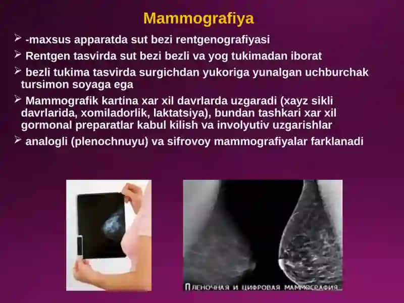 Sut bezlarini diagnostik tekshiruvusullari va kasalliklari 2
