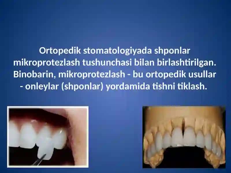 Vinirlarni tayyorlashning zamonaviy usullari 2