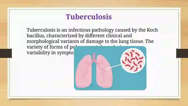 Tuberculosis 2