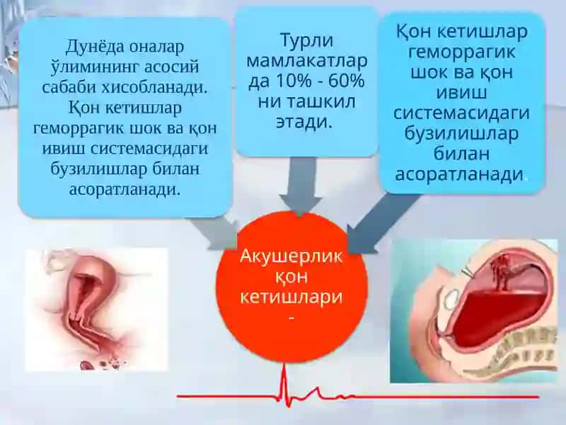 Хомиладорликнинг II – III триместрларида ҳамда туғруқдан кейинги қон кетишлар 2