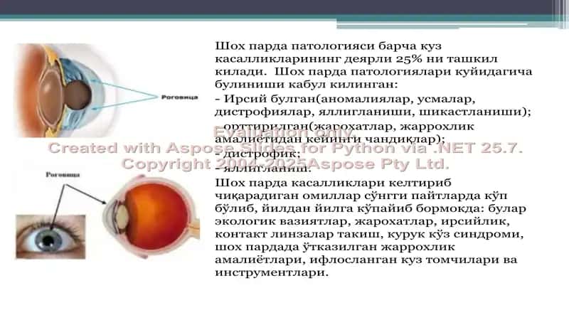 Шох парда касалликлари ва ularning daviyasi 2
