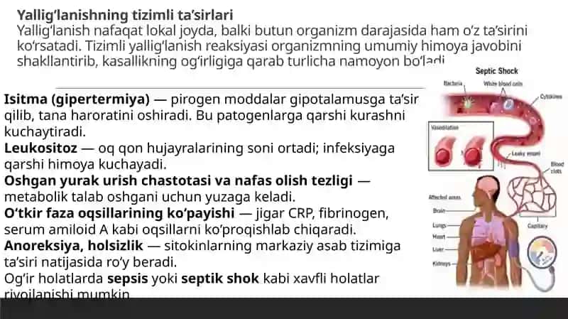Yallig’lanishni tizimli tasirlari 2