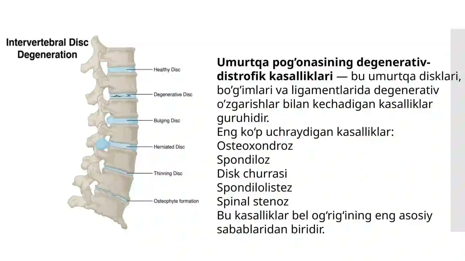Umurtqa pog'onasini degenerativ-distrofik kasalliklari: etiologiyasi,patogenezi, tasnifi, klinikasi, 2