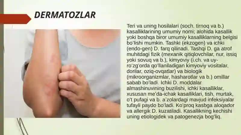 Dermatozlar va po'rsildi kasalliklari 2