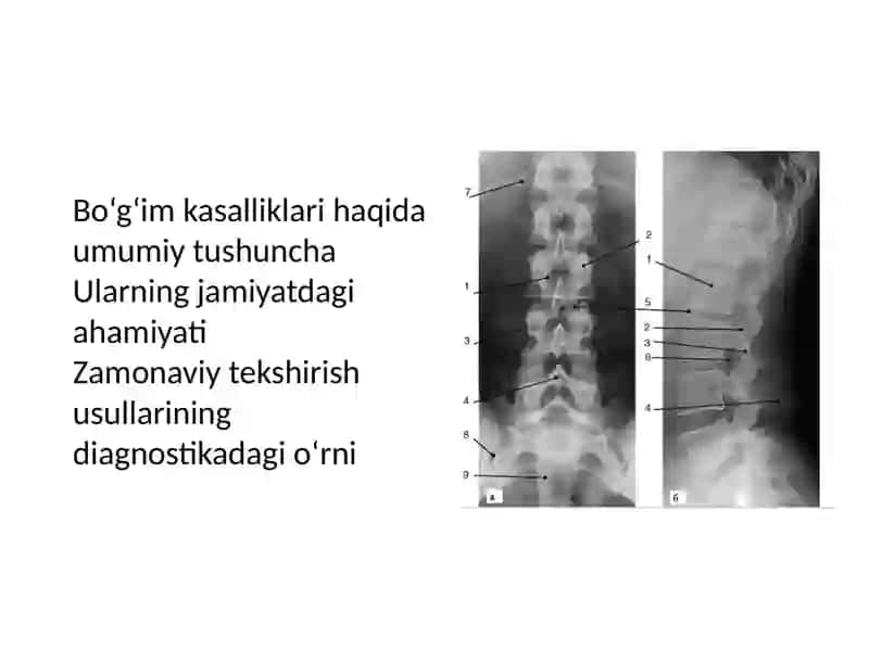 Bo'g'im kasalliklarini zamonaviy tekshirish usullari 2
