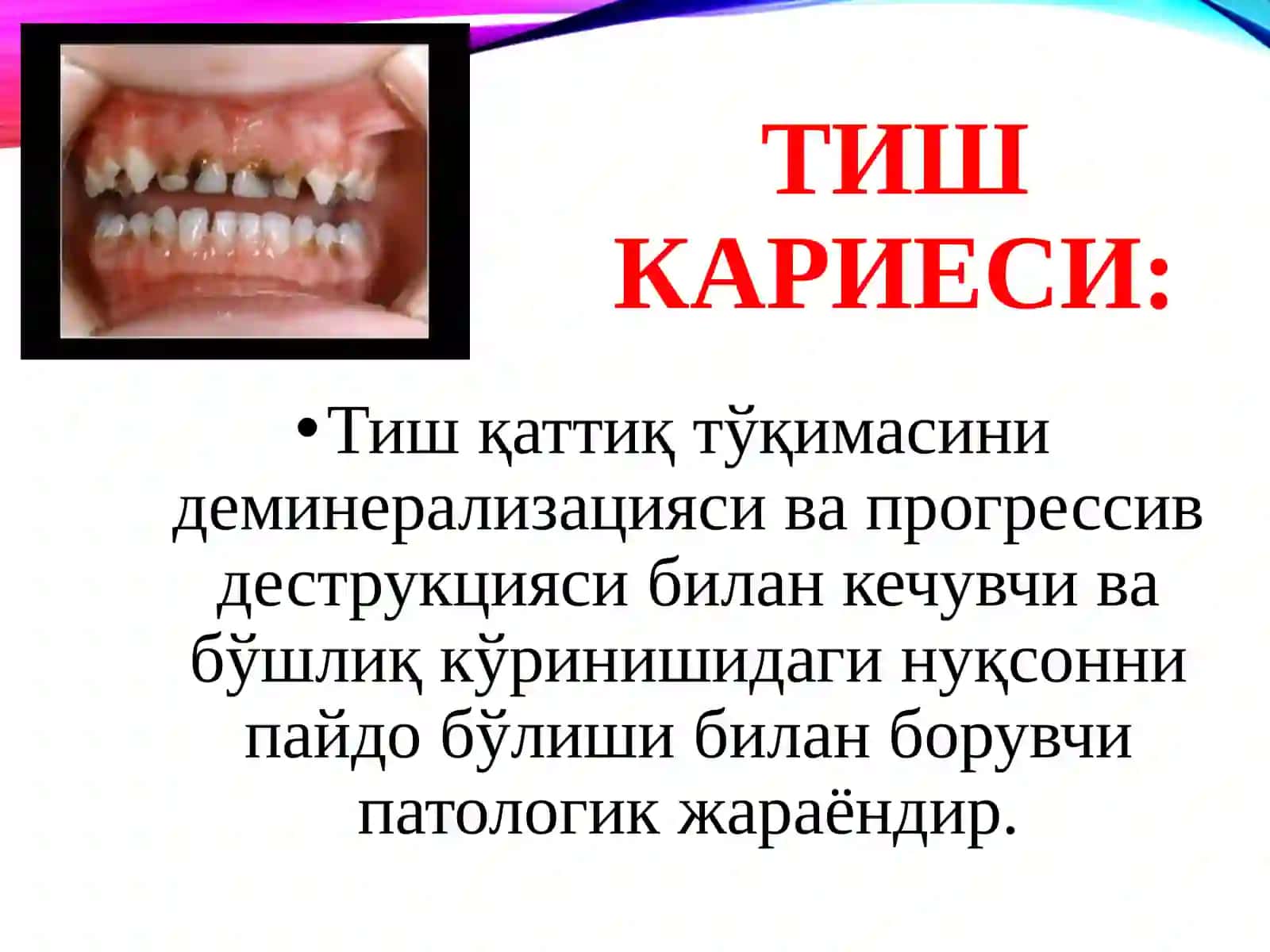 Хар ҳил босқичдаги кариес касалликларини клиникаси. Қиёсий ташҳиси. 2