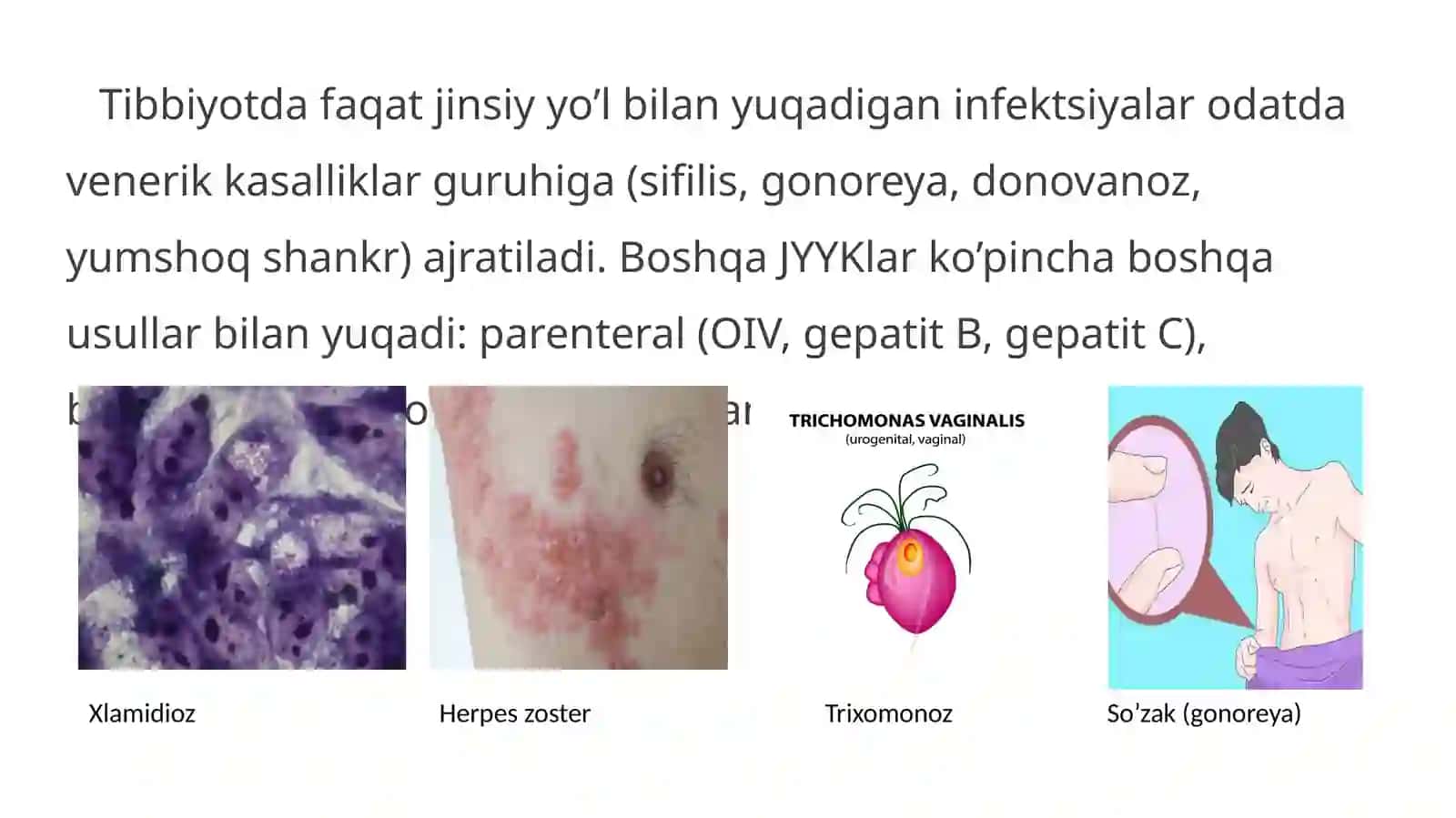 Jinsiy yo’l bilan yuqadigan kasallikalar profilaktikasi 2