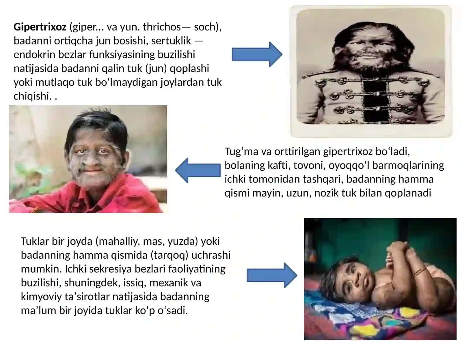 Ixtioz va gipertirixoz 2