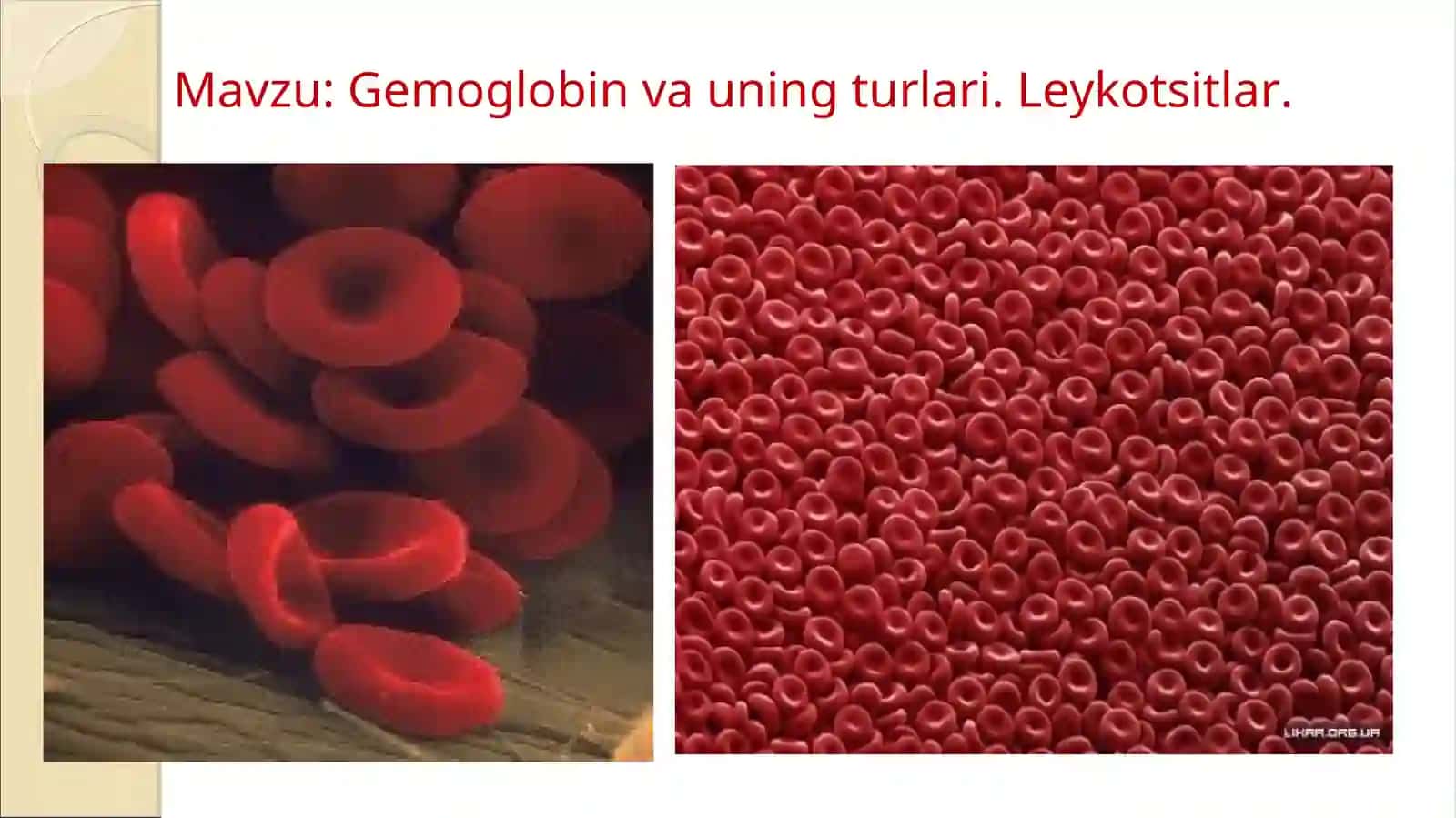 Slayd: Gemoglobin va uning turlari. Leykotsitlar 2