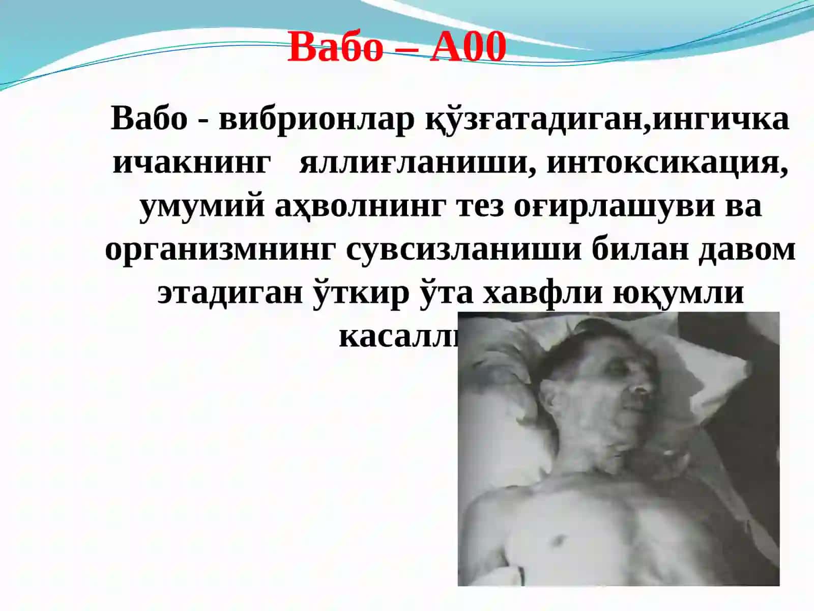 ВАБОКАСАЛЛИГИНИНГ ЭТИОЛОГИЯСИ, ЭПИДЕМИОЛОГИЯСИ ВАПРОФИЛАКТИКАСИ 2