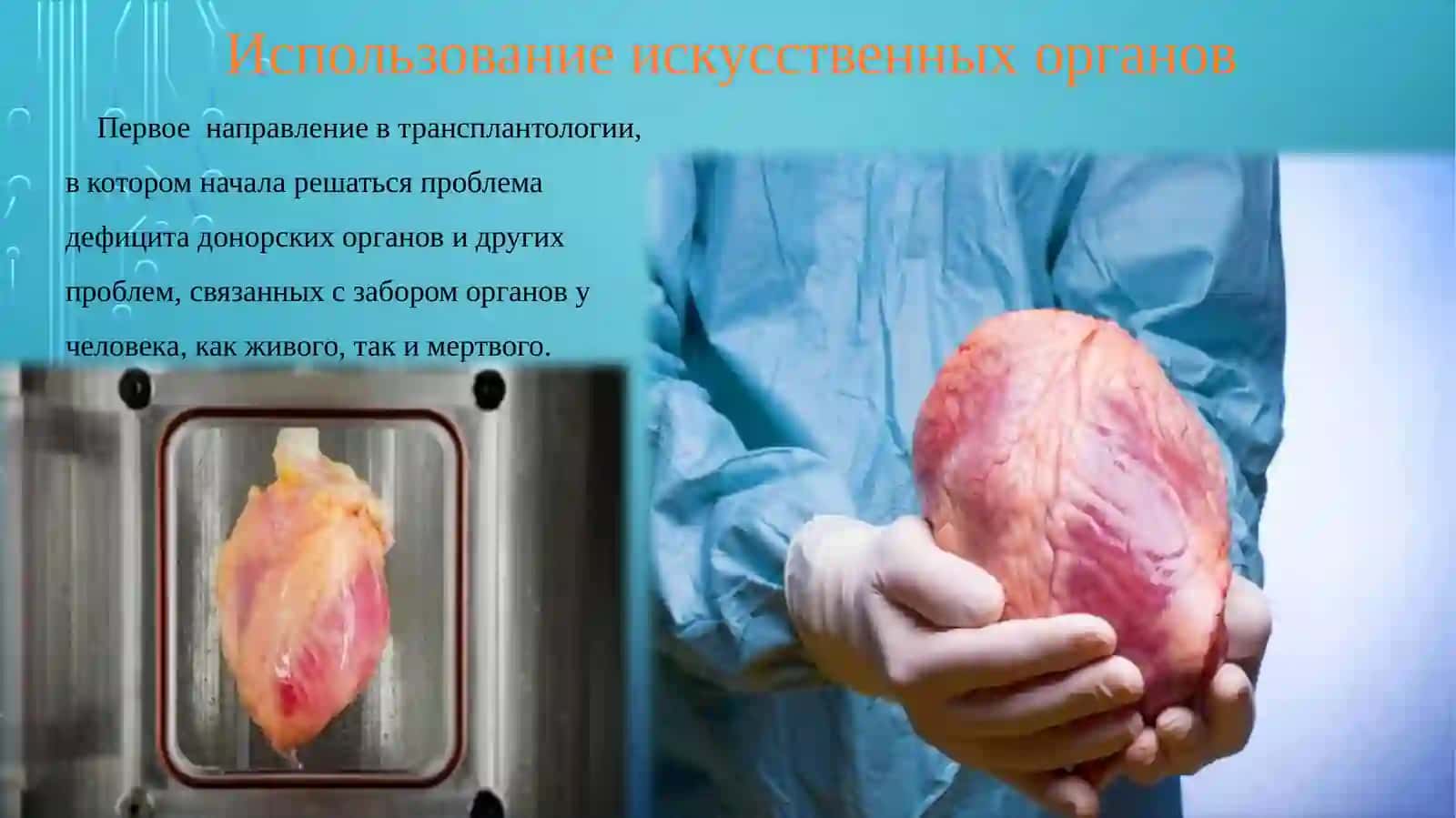 Проблемы создания искусственных органов для трансплантологии 2